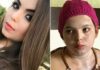 São Luís: Estudante queimada por desconhecida já fez cerca de 20 cirurgias e evolui bem ao tratamento, diz médica…