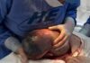 Iporá: Bebê nasce empelicado em hospital e vídeo viraliza